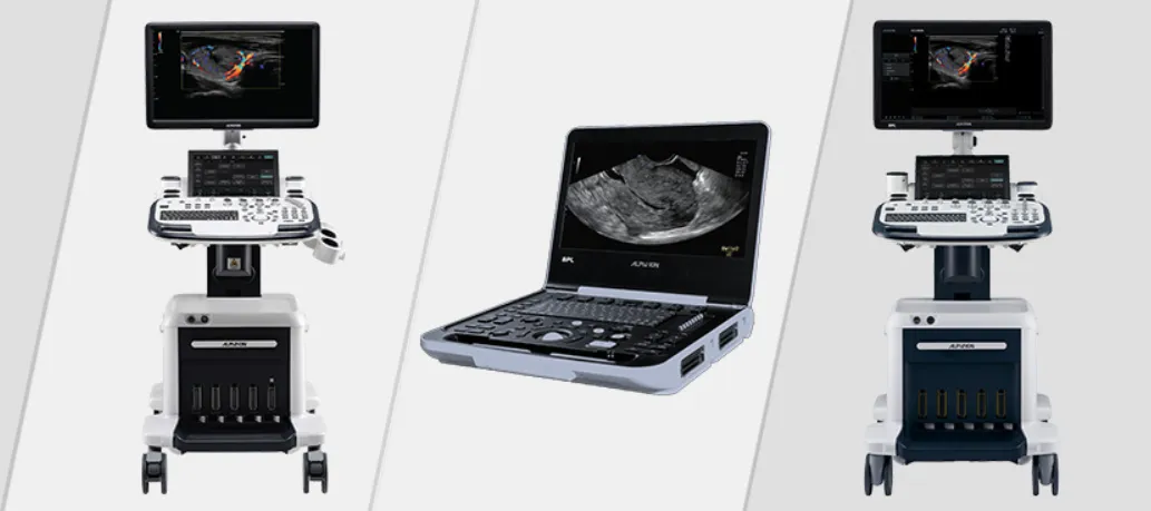 Ultrasound